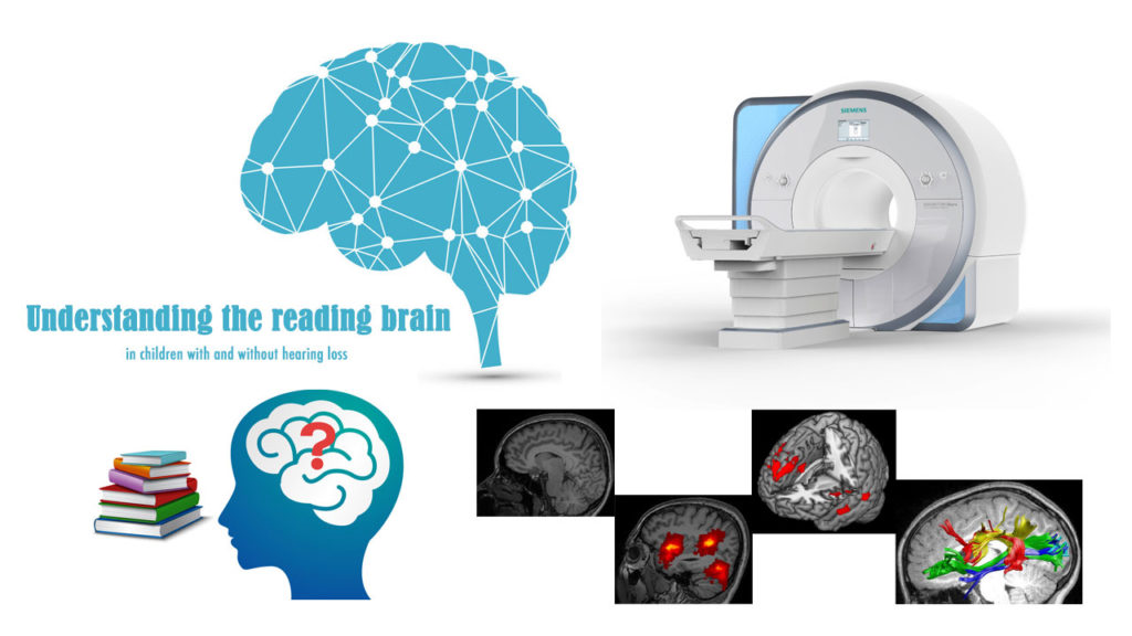 Understanding the Reading Brain – The NL3 Wang Lab